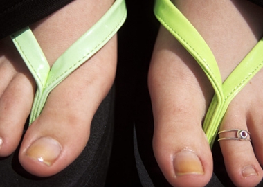 Flimsy flip-flops and sandals can cause pain and other unforeseen consequences. (Photo: Penn State)