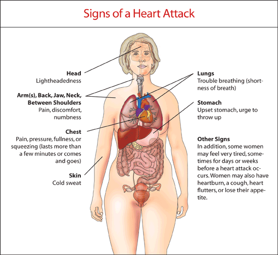Heart attacks don't always result in someone grasping their chest. (Illustration: naturalhealthstore.us)