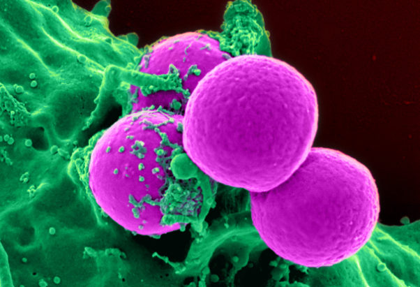 Methicillin-resistant Staphylococcus aureus (MRSA) bacteria cause a range of illnesses including skin and wound infections, pneumonia and bloodstream infections that can cause sepsis and death. (Image: National Institute of Allergy and Infectious Diseases)
