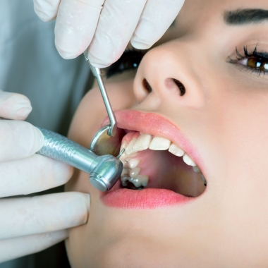 More than eight amalgam dental fillings could cause increased levels of mercury in your blood system, according to a new study. (Photo: Daniel Huszar)
