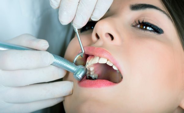 More than eight amalgam dental fillings could cause increased levels of mercury in your blood system, according to a new study. (Photo: Daniel Huszar)
