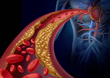 A study by Johns Hopkins Medicine found calcium supplements may cause plaque build up in the heart. (Photo: iStock)