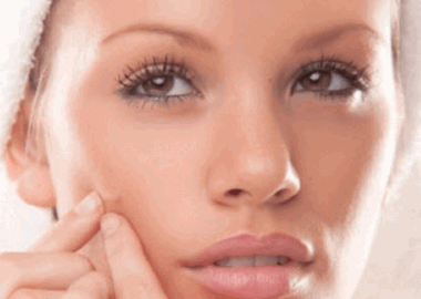 You should not pop blemishes because they will scar. (Photo: AcneAssasins)