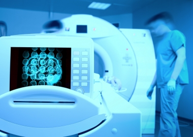 Glioblastoma is typically discovered after a patient seeks medical attention for neurological symptoms that have come on suddenly, such as headaches or vision changes. (Photo: Thinkstock)