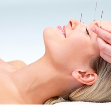 An accupuncture facial helps increase blood flow to keep your face bright. (Photo: Talapias Community Accupuncture)