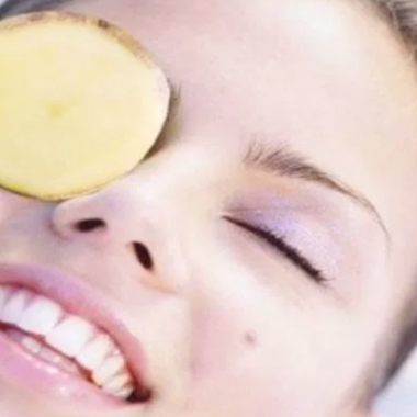 Potatos bleach skin naturally when used over time, making them great for dark circles. (Photo: DIY Health Remedy)