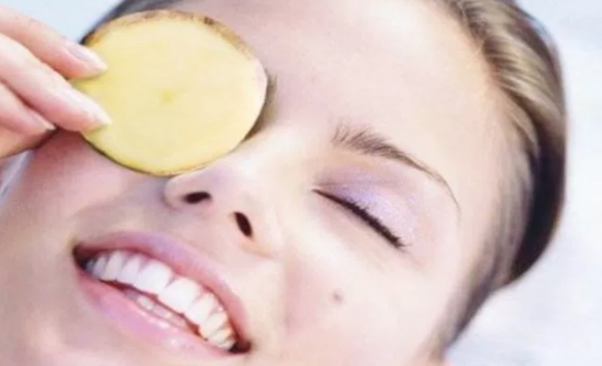Potatos bleach skin naturally when used over time, making them great for dark circles. (Photo: DIY Health Remedy)
