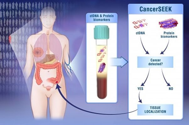 CancerSEEK can detect eight types of cancers and the location. (Graphic: Elizabeth cook and Kaitlin LIndsay/Johns Hopkins)