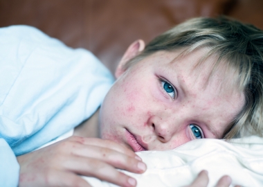 Measles are on the rise in Europe. In the U.S. so far this year, the CDC has reported 124 cases in 22 states and D.C. (Photo: Getty Images)