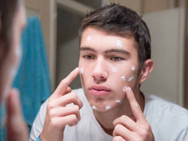 http://dconheels.com/wp-content/uploads/2018/09/teen-acne-shutterstock.jpg