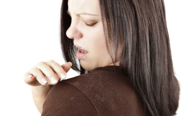 A woman brushing dandruff off her shoulder. (Photo: Shutterstock)