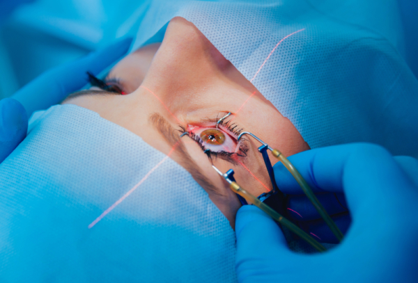 Person's face draped for surgery with gloved hand placing device to keep eye open during surgery. (Photo; Shutterstock)