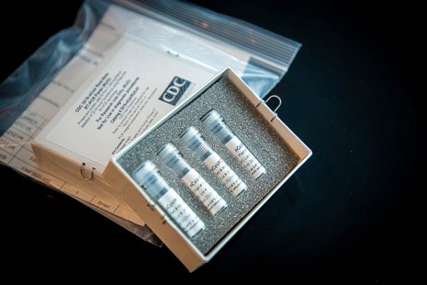 A coronavirus test kit with 4 blood vials in a box. (Photo: CDC)