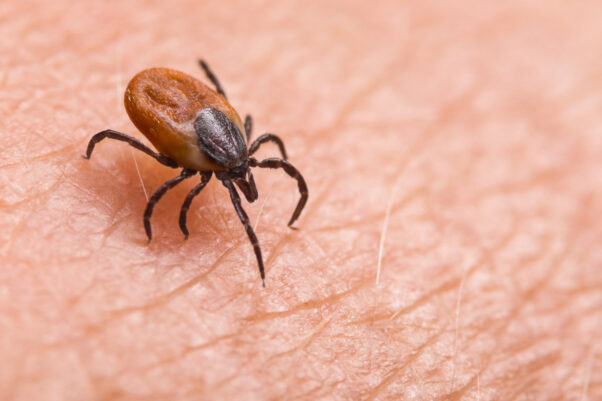 Deer tick on hairy skin. (Photo: Shutterstock)