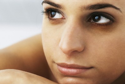 Dark, puffy circles under the eye can affect anyone and can have a variety of causes. ){{Photo: nutritiousdelicious.com)